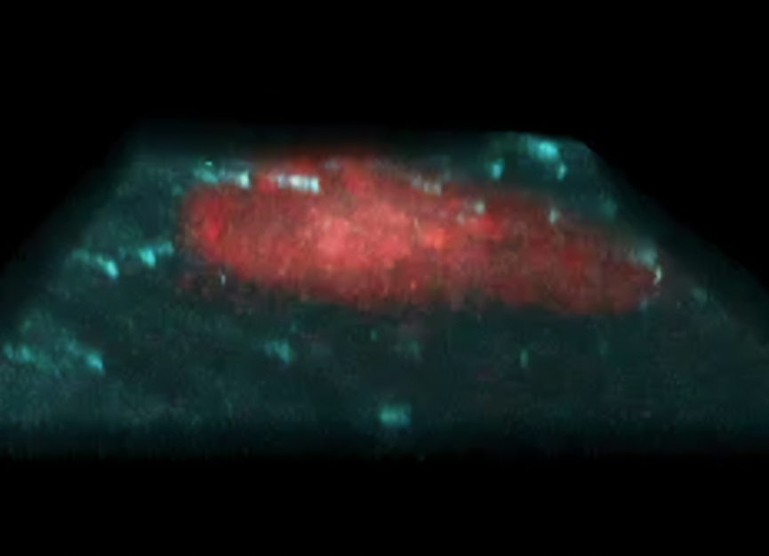 Game-changing alternative to blood thinners