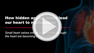 Our hidden ageing video news release