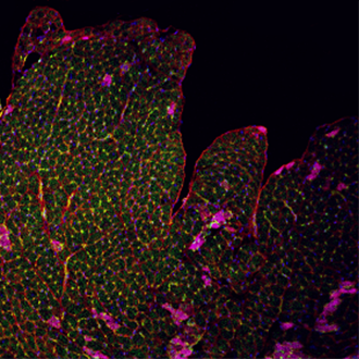 Genetic risk prediction