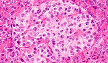 Beta-like cells in the pancreas