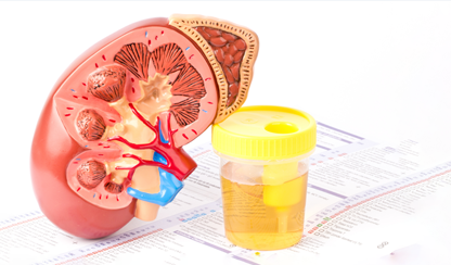 Diagnosis of kidney disease progression