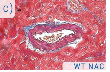 Novel treatments for obesity related hypertension - C