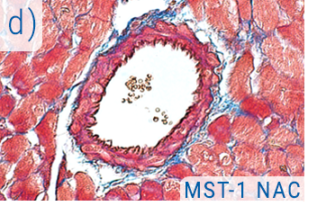 Novel treatments for obesity related hypertension - D